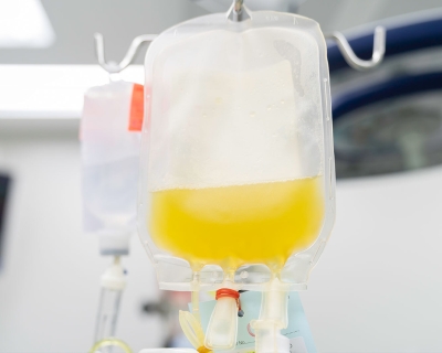 IV bag containing plasma