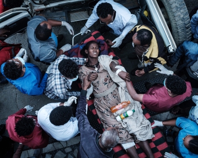 An injured resident of Togoga arrives at the Ayder referral hospital in Mekele, the capital of Tigray region, Ethiopia, on June 23, 2021. Yasuyoshi CHIBA / AFP via Getty Images